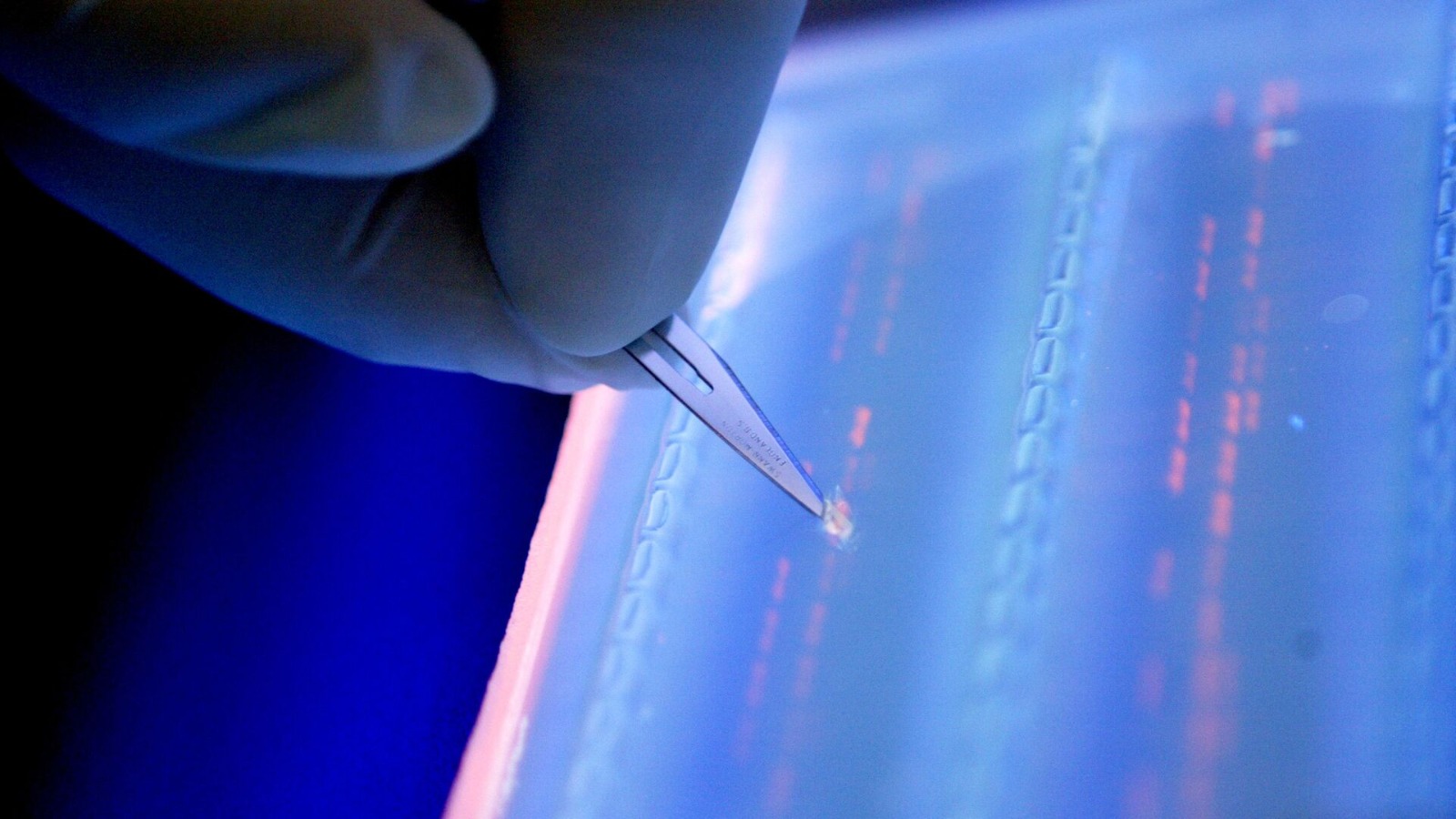 "موديرنا" تبشر العالم بجاهزية لقاح علاج السرطان خلال 2030