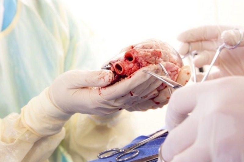 إعلان على فيسبوك يُسقط شبكة تتاجر في الأعضاء البشرية بالدارالييضاء